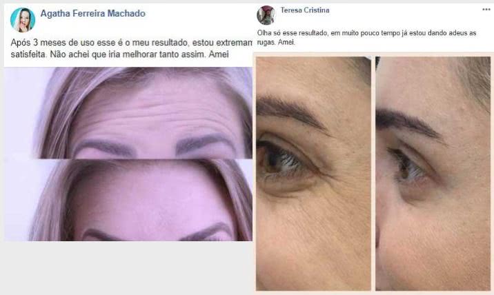 Dermacaps Preço